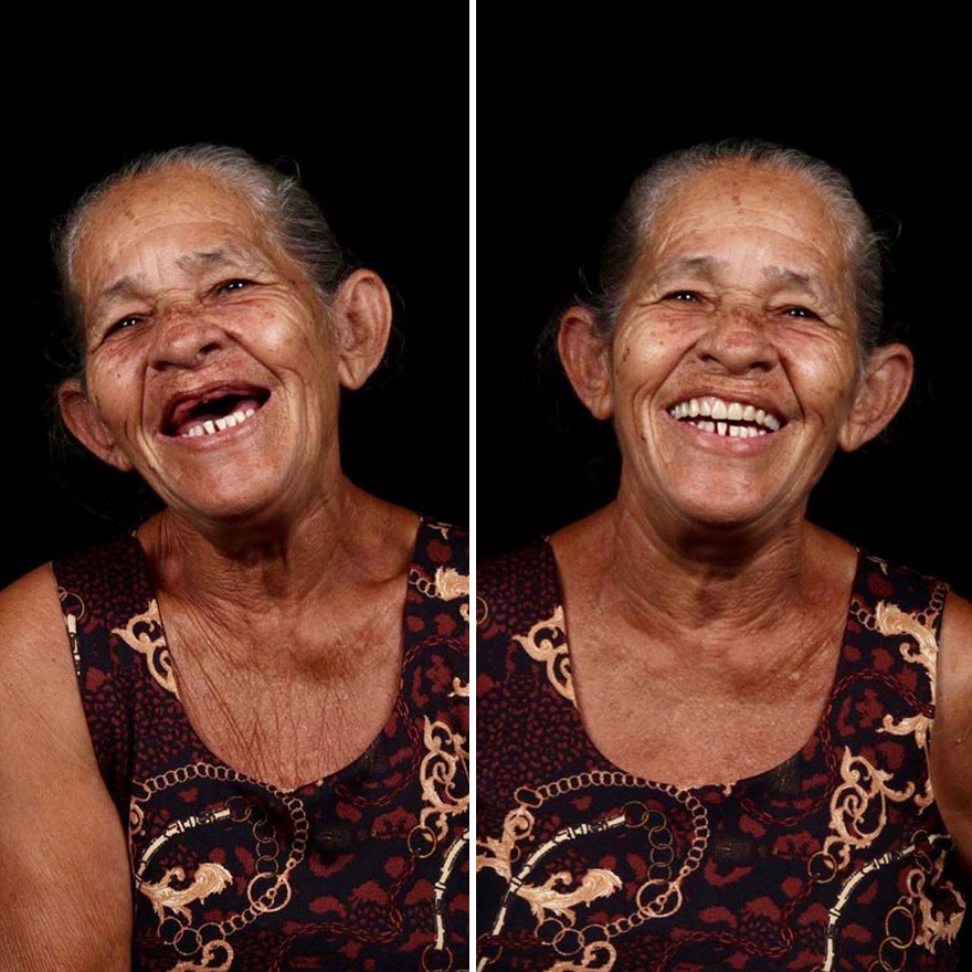 Стоматолог од Бразил патува низ светот и им ги поправа забите на луѓето кои не можат да си го дозволат тоа