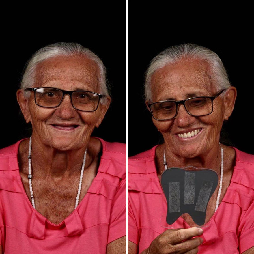 Стоматолог од Бразил патува низ светот и им ги поправа забите на луѓето кои не можат да си го дозволат тоа