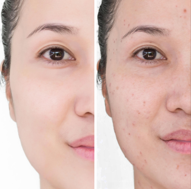 6 проблеми што марамчињата за отстранување шминка можат да ѝ ги направат на вашата кожа