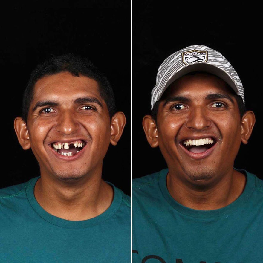 Стоматолог од Бразил патува низ светот и им ги поправа забите на луѓето кои не можат да си го дозволат тоа