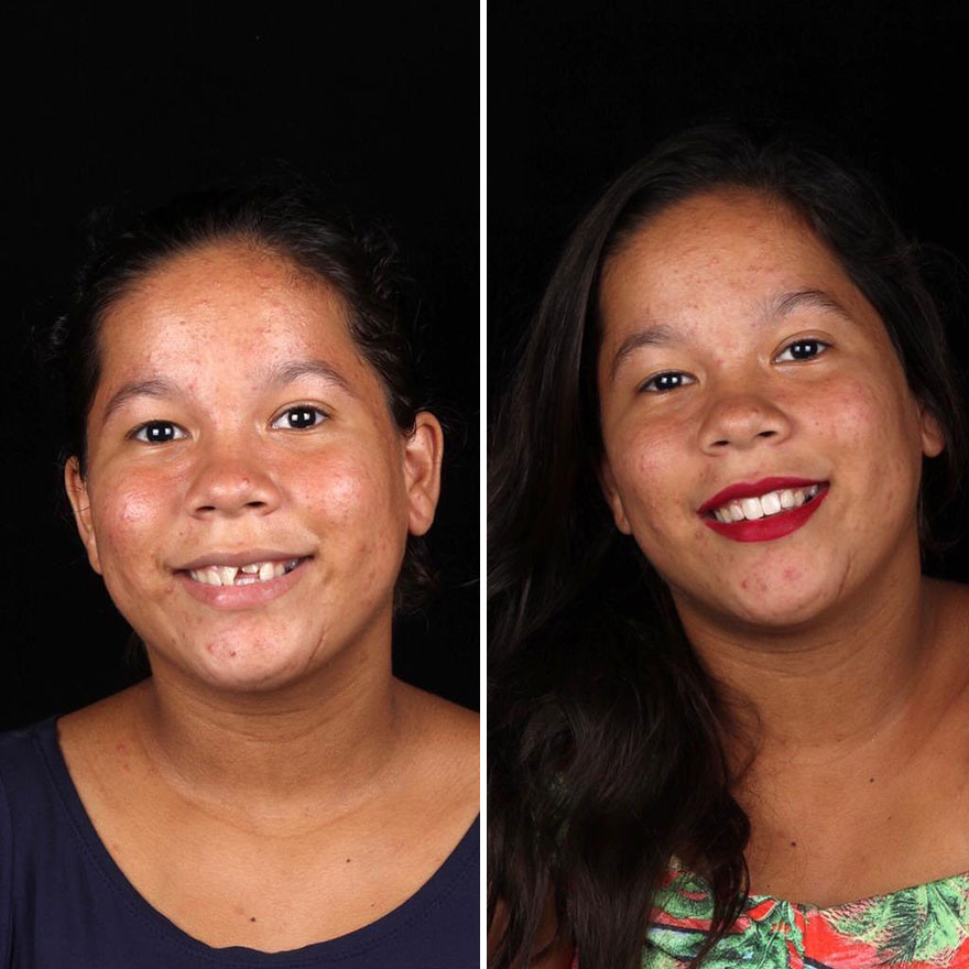 Стоматолог од Бразил патува низ светот и им ги поправа забите на луѓето кои не можат да си го дозволат тоа