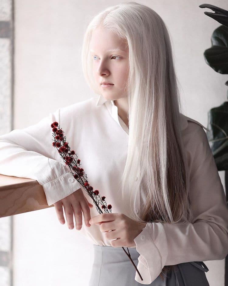 Портрети кои ја истакнуваат уникатната убавина на една девојка со албинизам и хетерохромија
