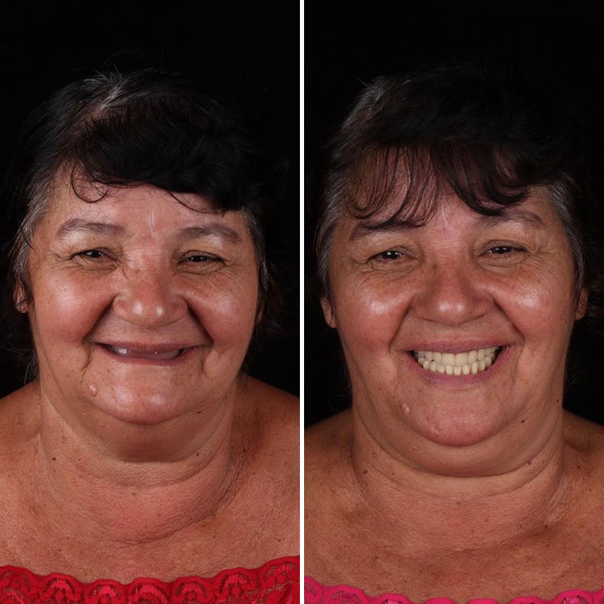 Стоматолог од Бразил патува низ светот и им ги поправа забите на луѓето кои не можат да си го дозволат тоа