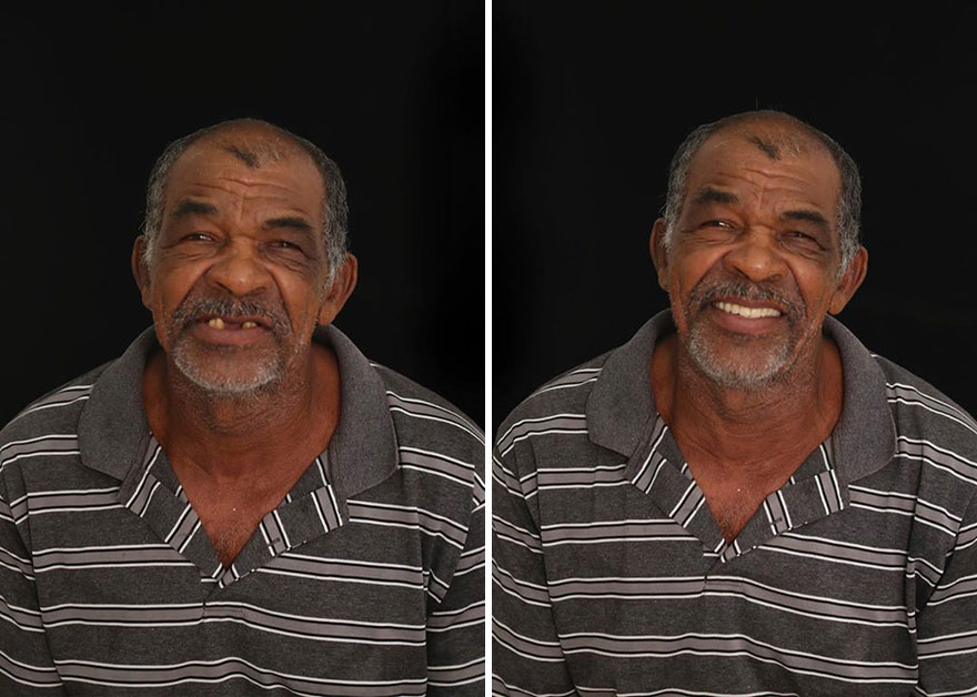 Стоматолог од Бразил патува низ светот и им ги поправа забите на луѓето кои не можат да си го дозволат тоа