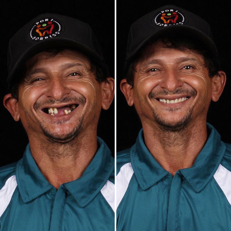 Стоматолог од Бразил патува низ светот и им ги поправа забите на луѓето кои не можат да си го дозволат тоа