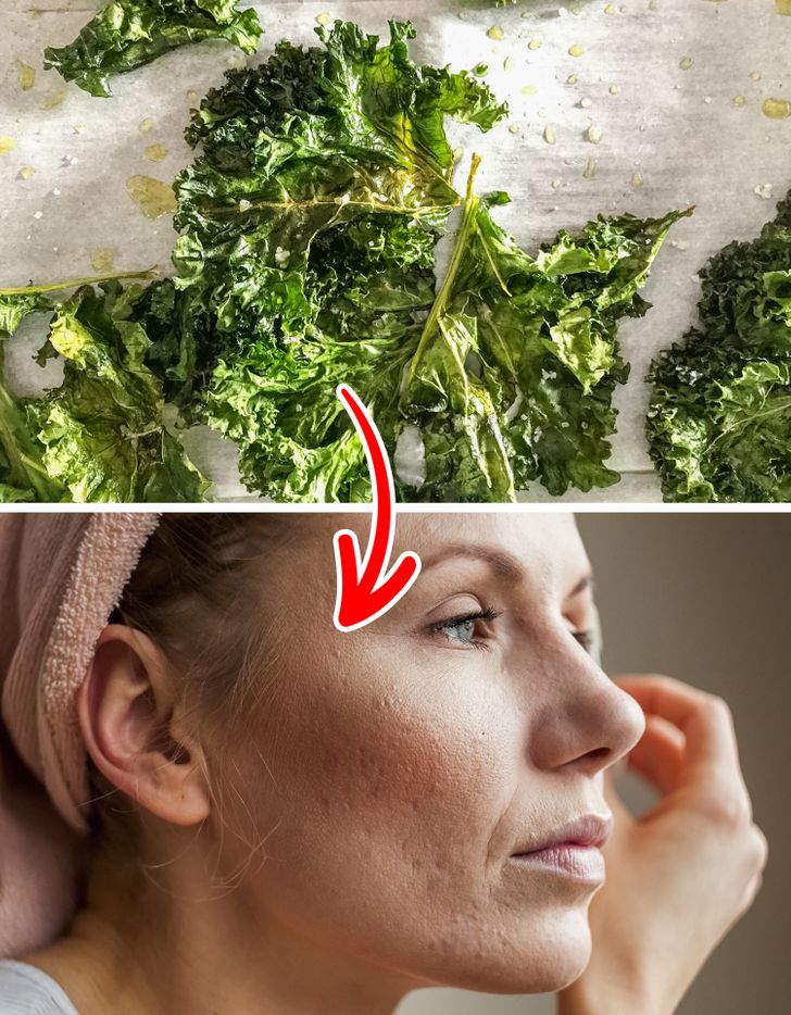 7 намирници што ги намалуваат лузните од акни