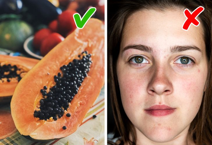 7 намирници што ги намалуваат лузните од акни