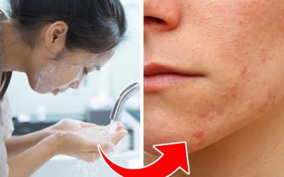 7 грешки во негата на кожата што може да ви создадат акни