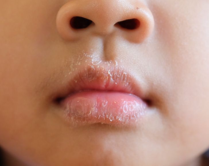 Што може да им се случи на децата ако спијат со отворена уста?