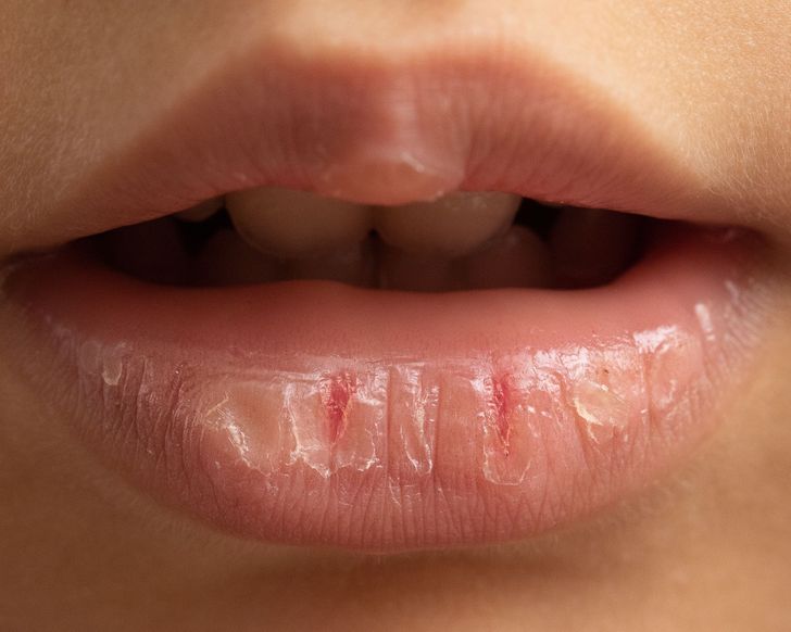 Што ќе се случи со вашите усни ако користите балсам за усни премногу често?