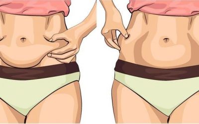 Како да ја затегнете кожата на стомакот по слабеењето или породувањето?
