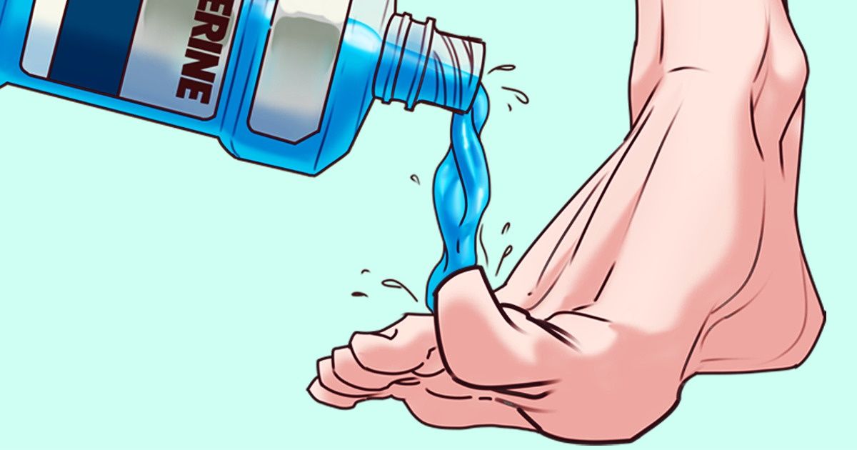 Како да ги негувате стапалата со помош на Листерин - средство за плакнење на устата